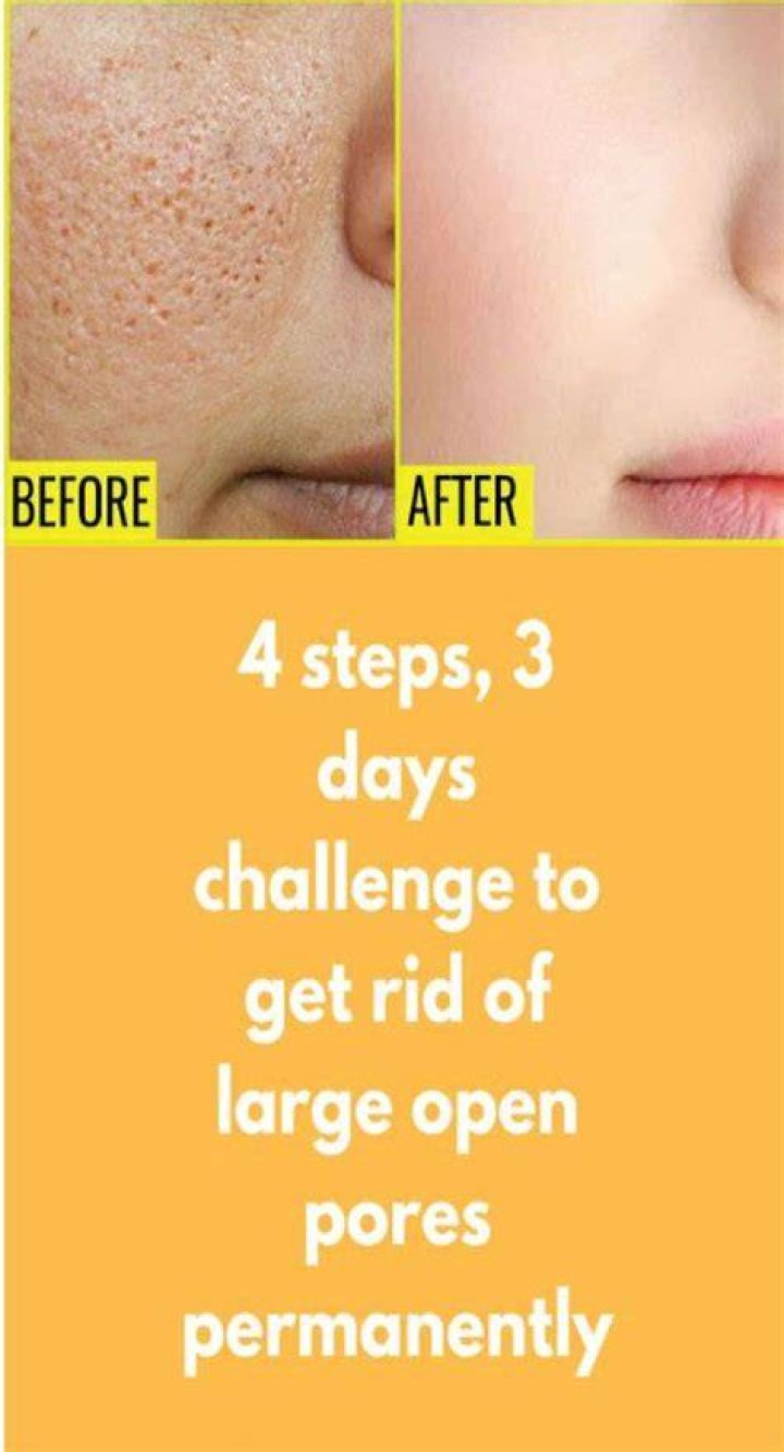 Can turmeric reduce open pores?