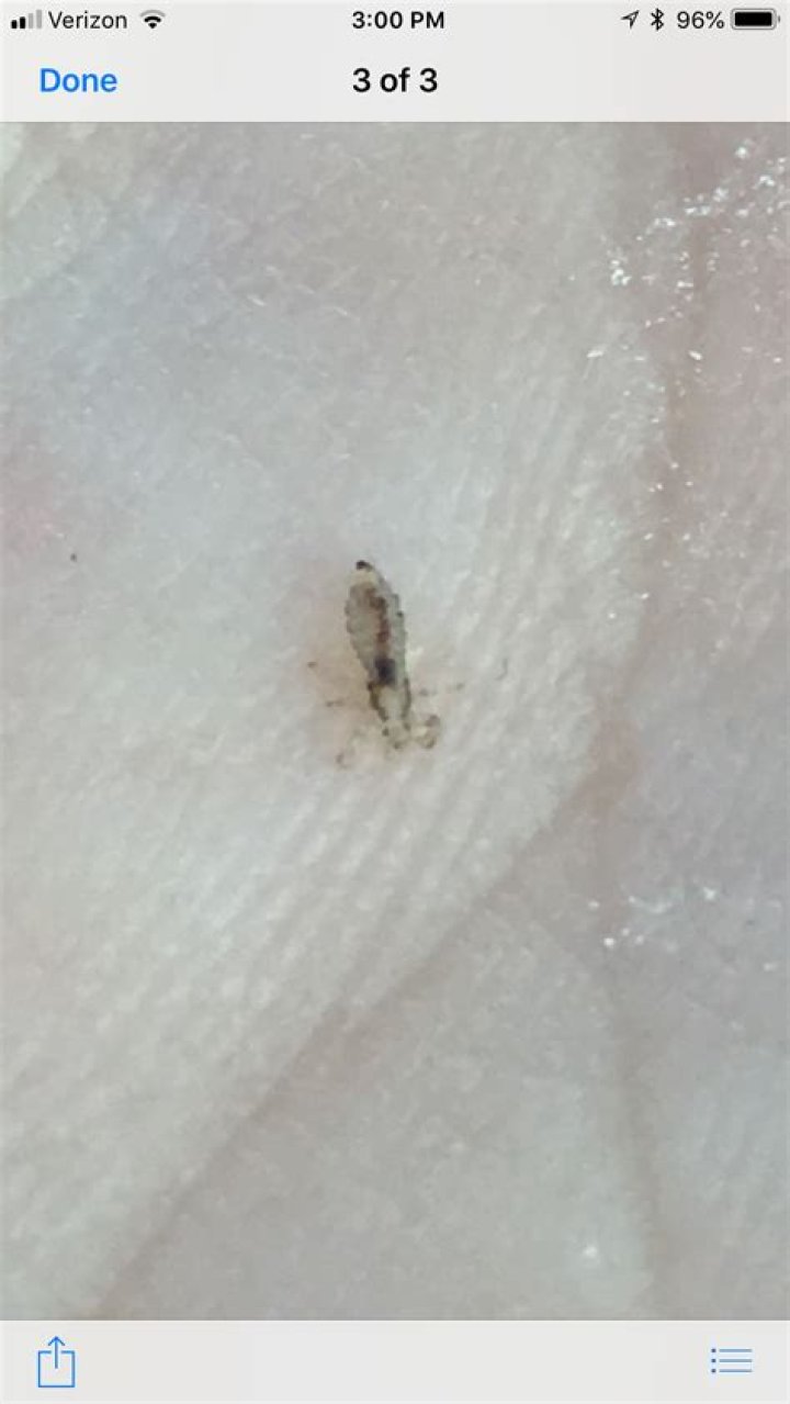 Can u get lice from a pillow?
