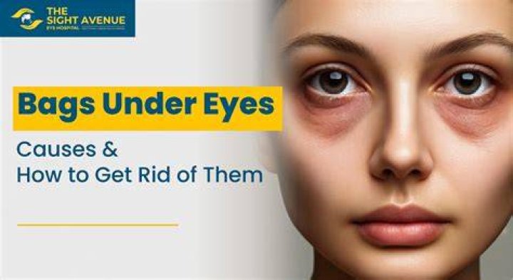 How can a teenage girl get rid of bags under his eyes?