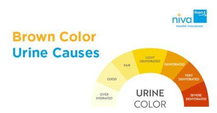 What foods cause brown urine?
