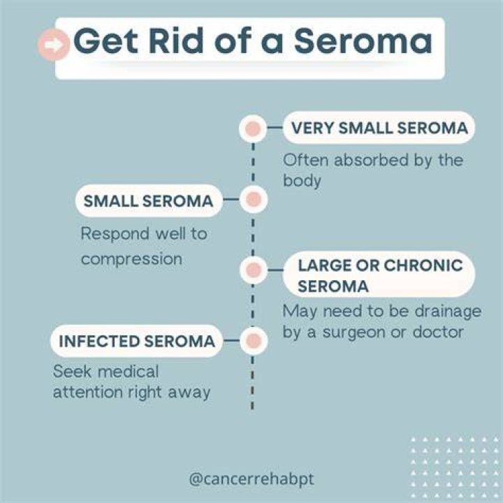 Why does my seroma keep refilling?