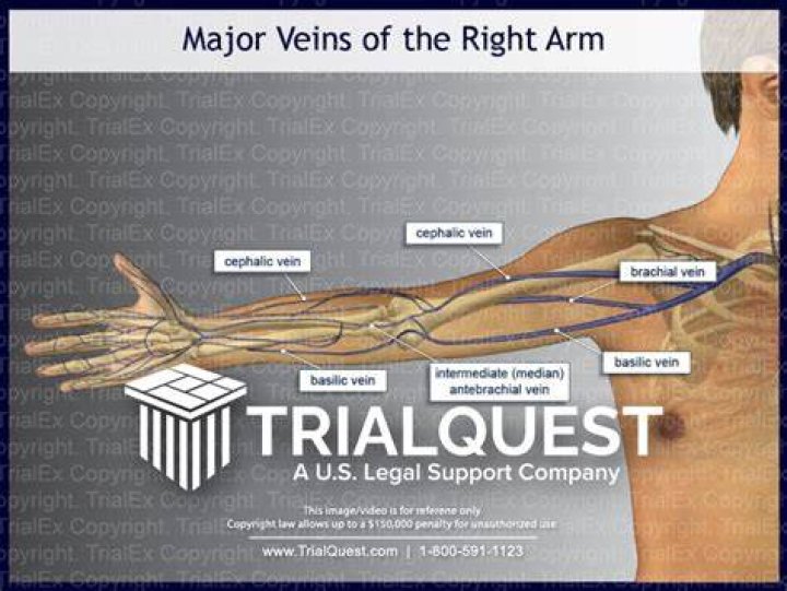 Why is the vein in my arm throbbing?